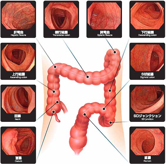 キレイな大腸の画像