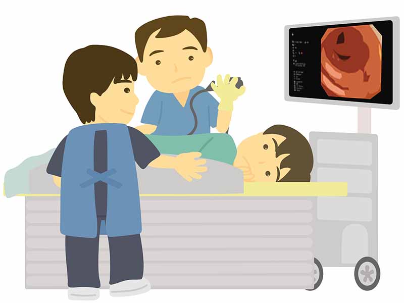 大腸検査、大腸内視鏡検査