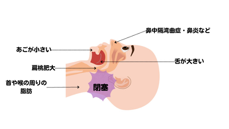 仕組み