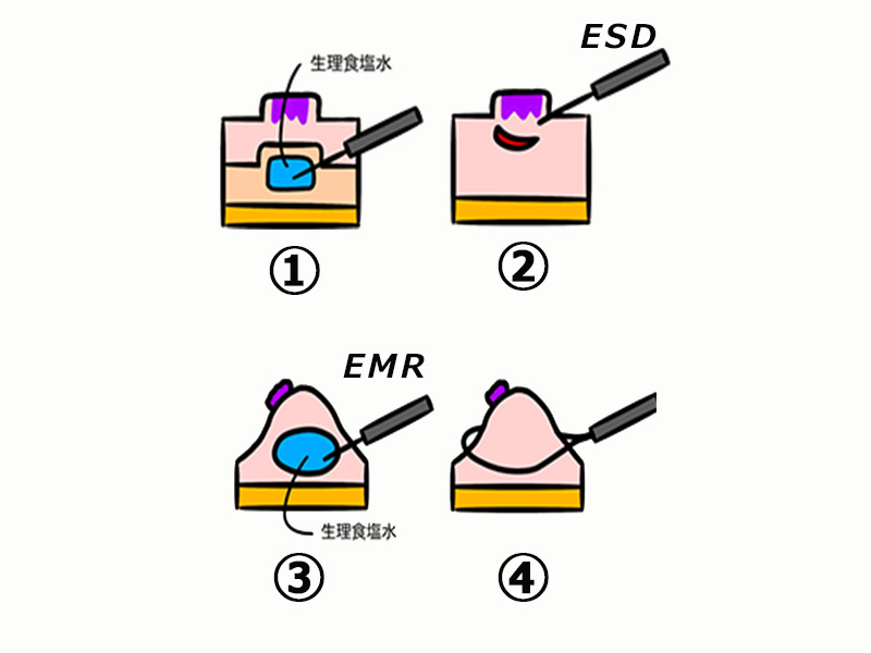 EDS_EMR