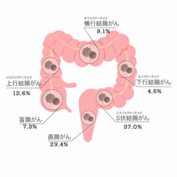 大腸がん発生頻度